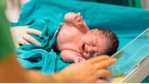 Circumcision: Preparation, Procedure, and Pros and Cons