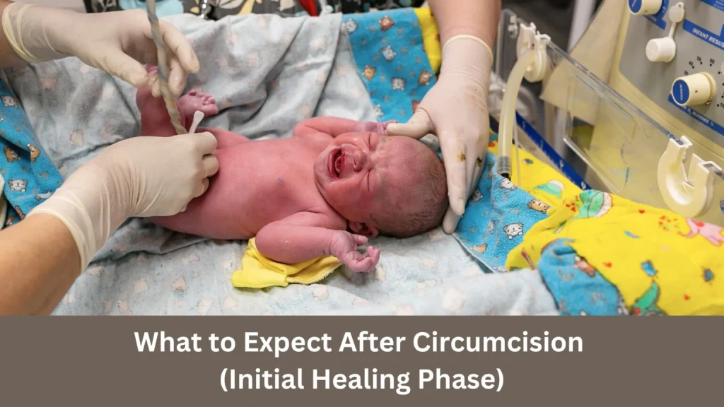 What to Expect After Circumcision
