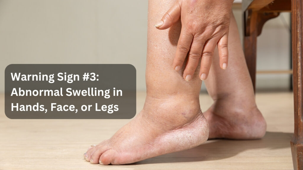 Warning Sign #3 Abnormal Swelling in Hands, Face, or Legs