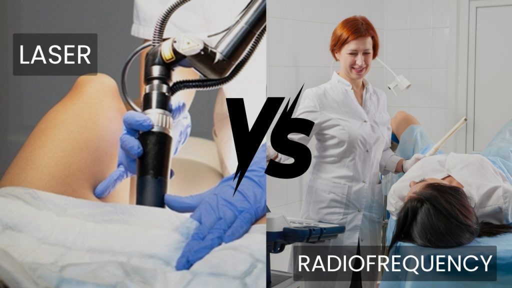 Laser vs. Radiofrequency Vaginal Rejuvenation