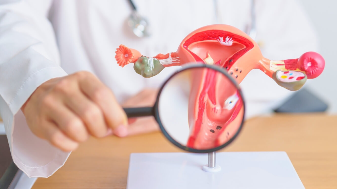 Ovarian Cysts: Symptoms, Types, and When to See a Doctor