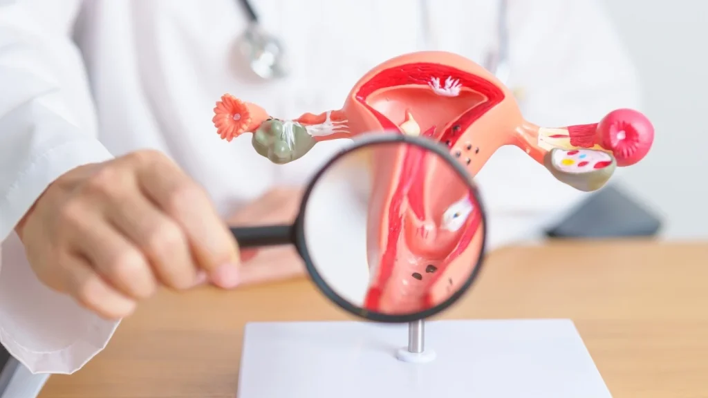 Endometriosis vs. Adenomyosis Understanding the Difference